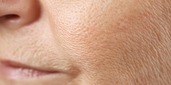 Colágeno para la piel: piel seca y cómo recuperarla de forma efectiva